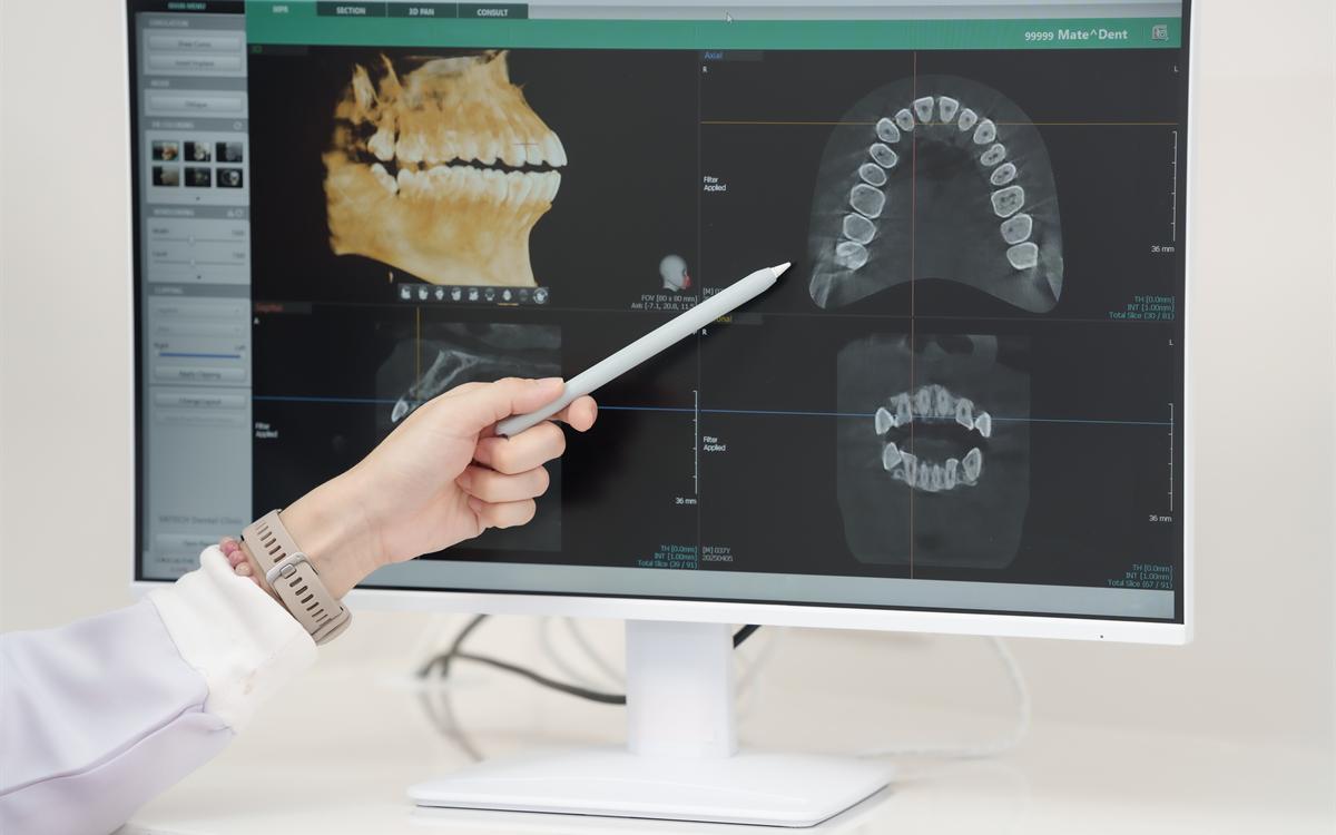 El dentista señala una radiografía dental en la pantalla.